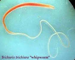 Whipworm & Natural Tropical Diseases – A Silent Killer