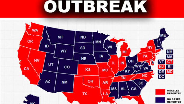 Measles+Continues+to+Ravage